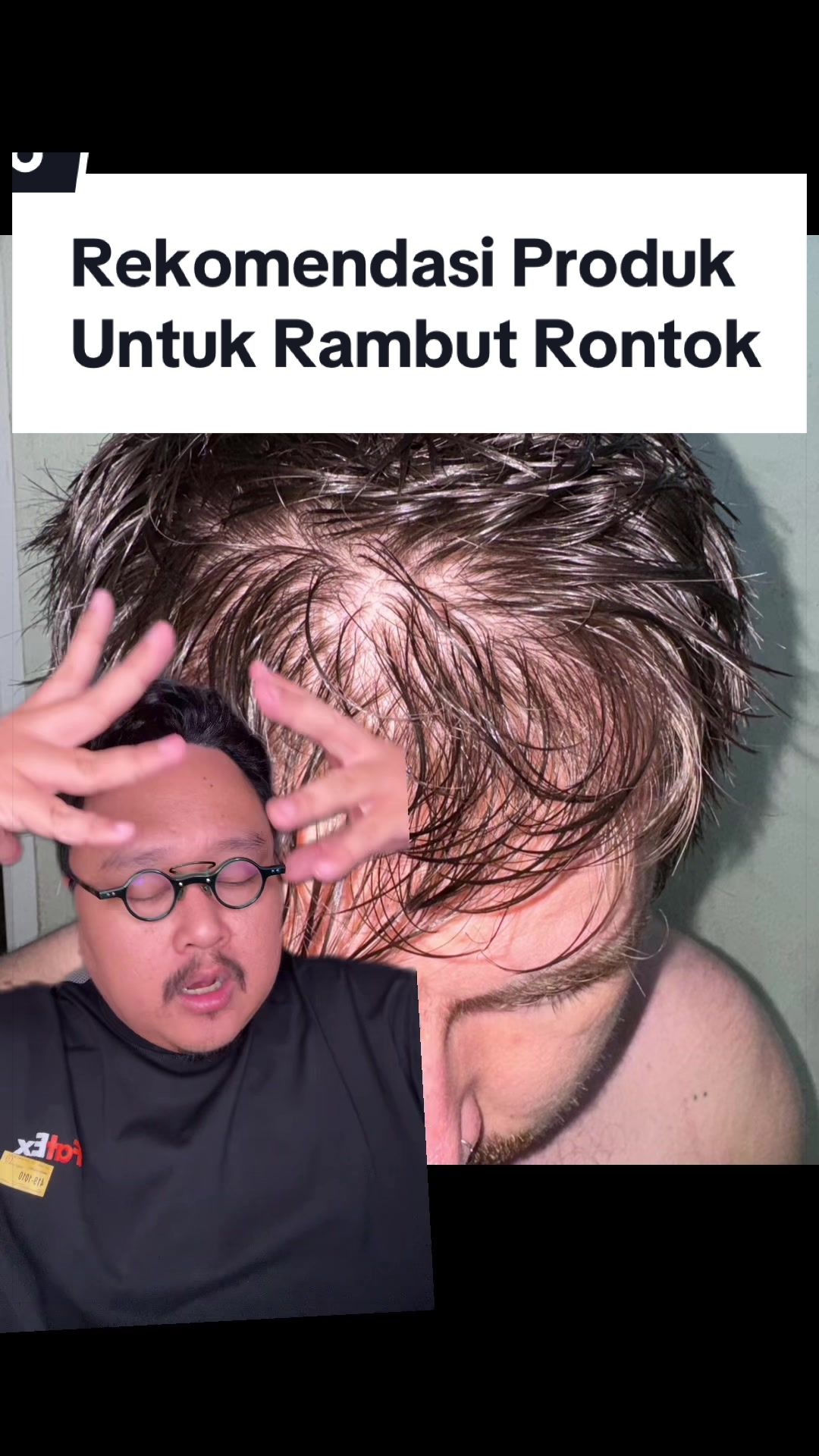 @Ali | @HungryForSkincare