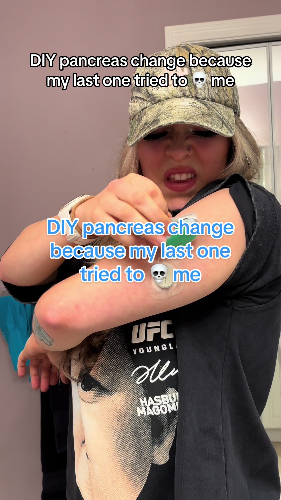 @TYPE 1 DEEABETES