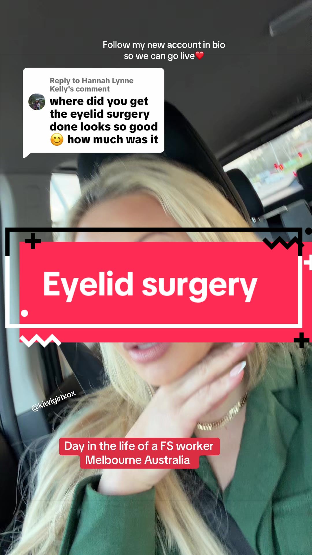 @Kiwigirlxox