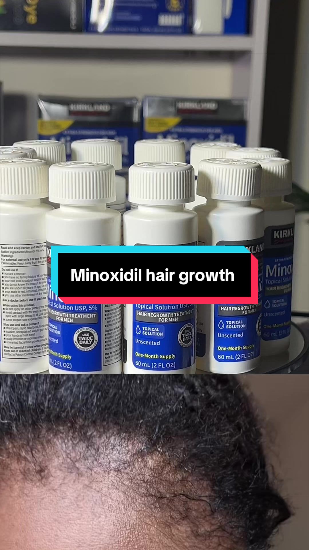 @Aunty solution skin and hair