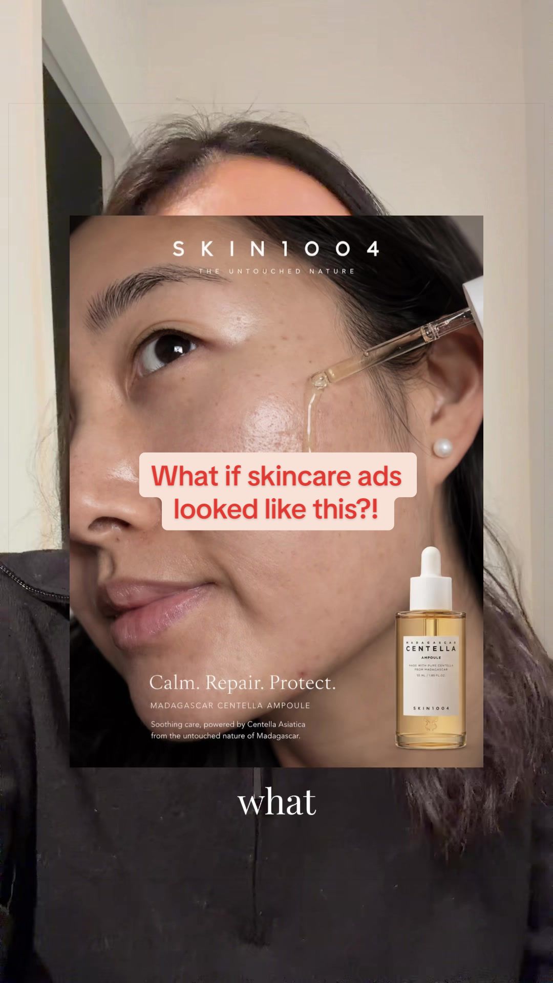 @Lisa | acne &rarr; clear skin