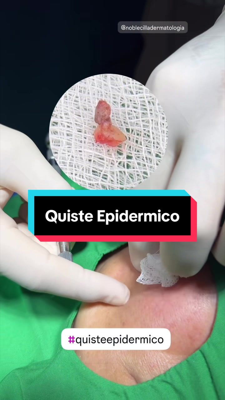 @Dr. Wilfrido Solano Derma