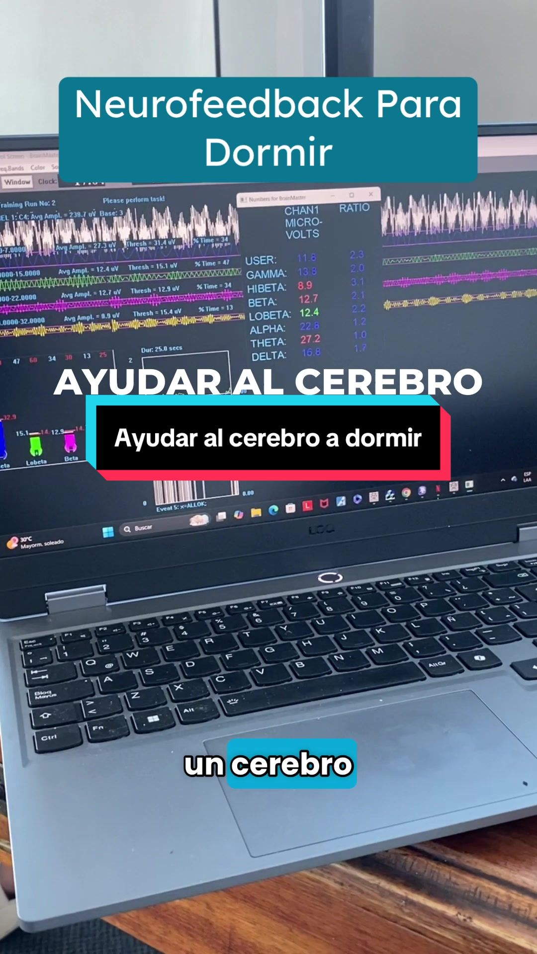 @Psicodelexito