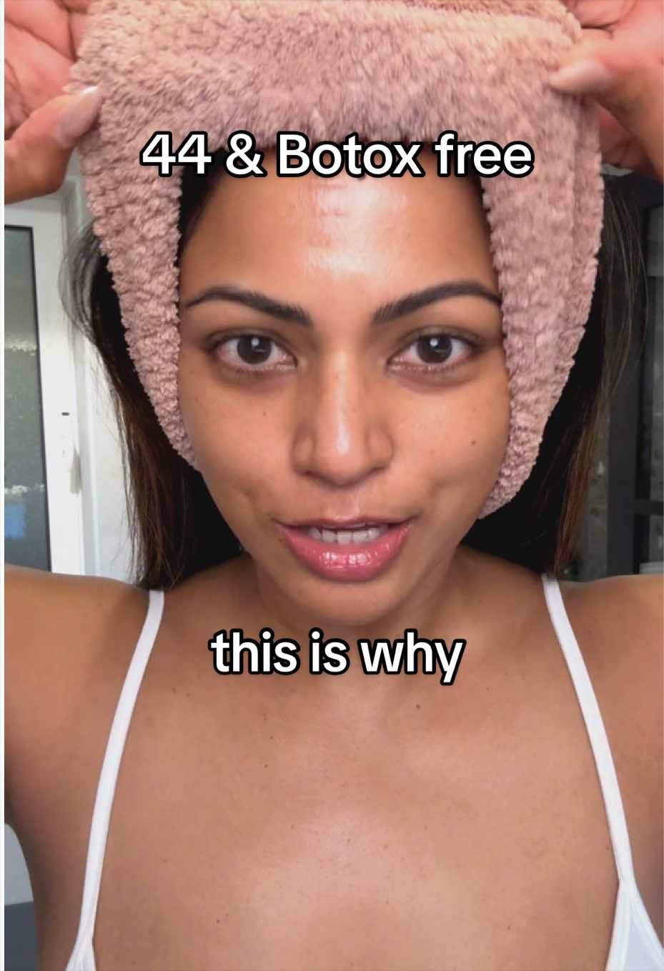 @Dee | Hyperpigmentation