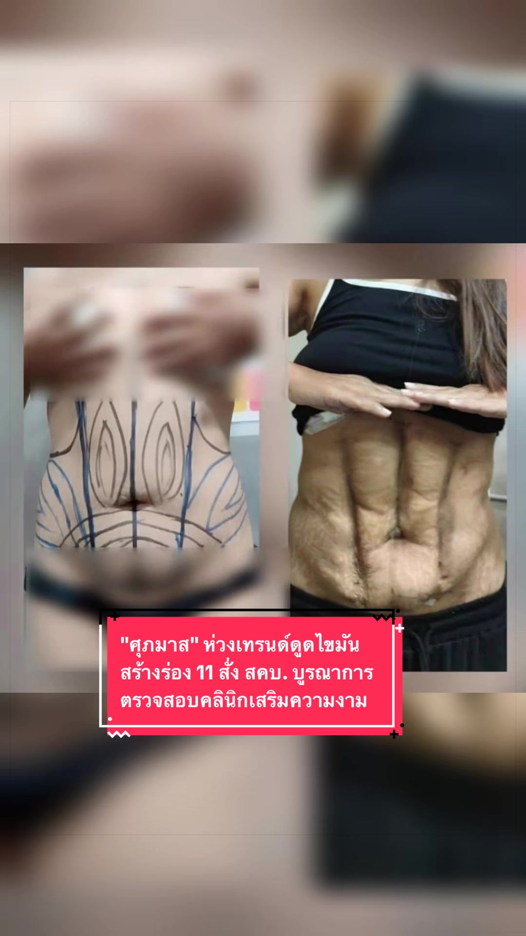 @nine10nine10