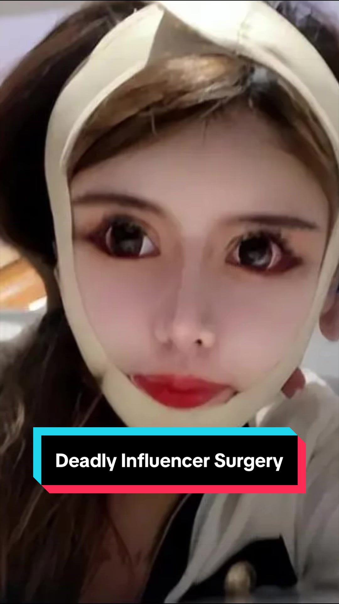 @Wonny