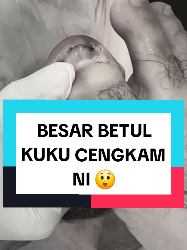 @Rawatan Kulit,Echo,Antenatal