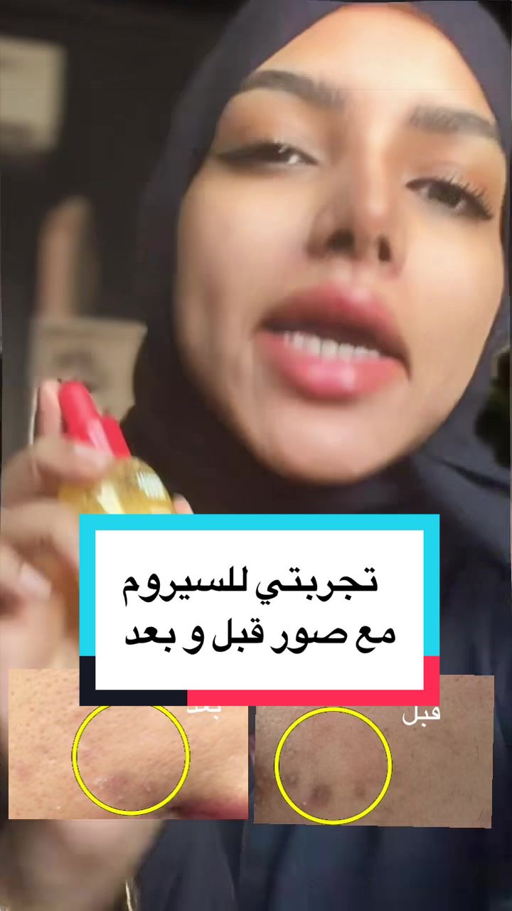 @VLOSCA - فلوسكا