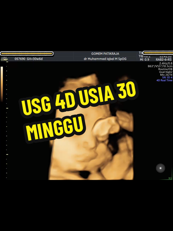 @USG 4D PURWOKERTO