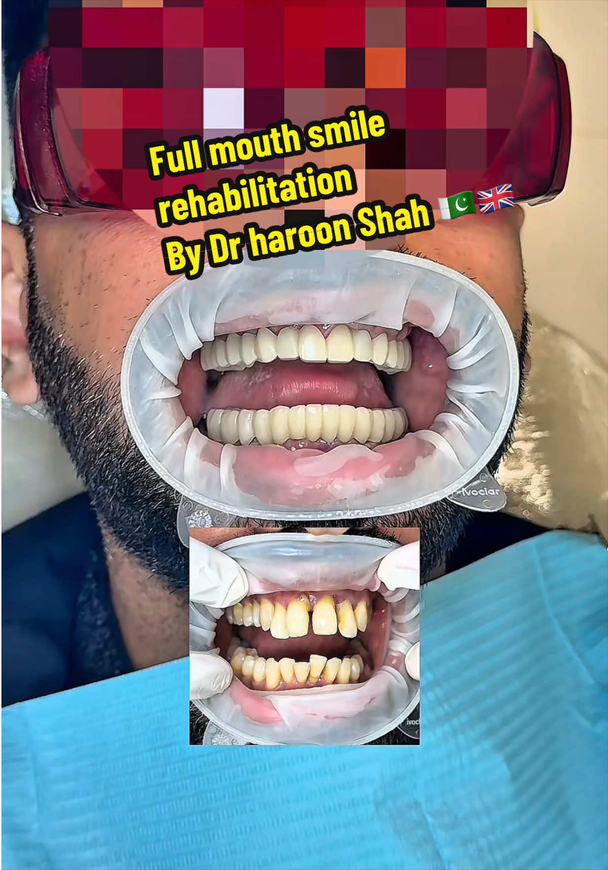 @Dr Haroon Shah