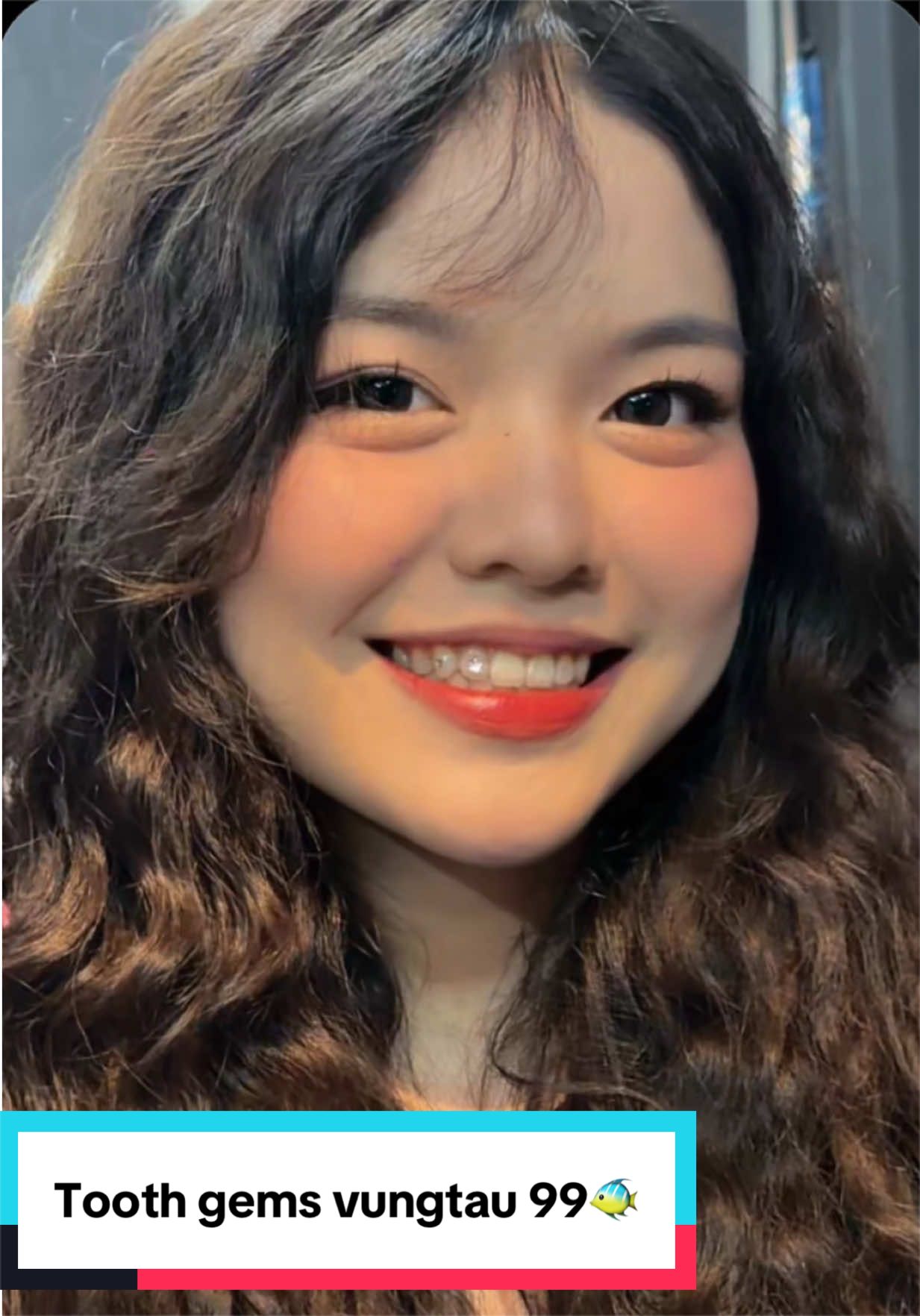 @Xỏ khuyên-ToothGems Vũng Tàu