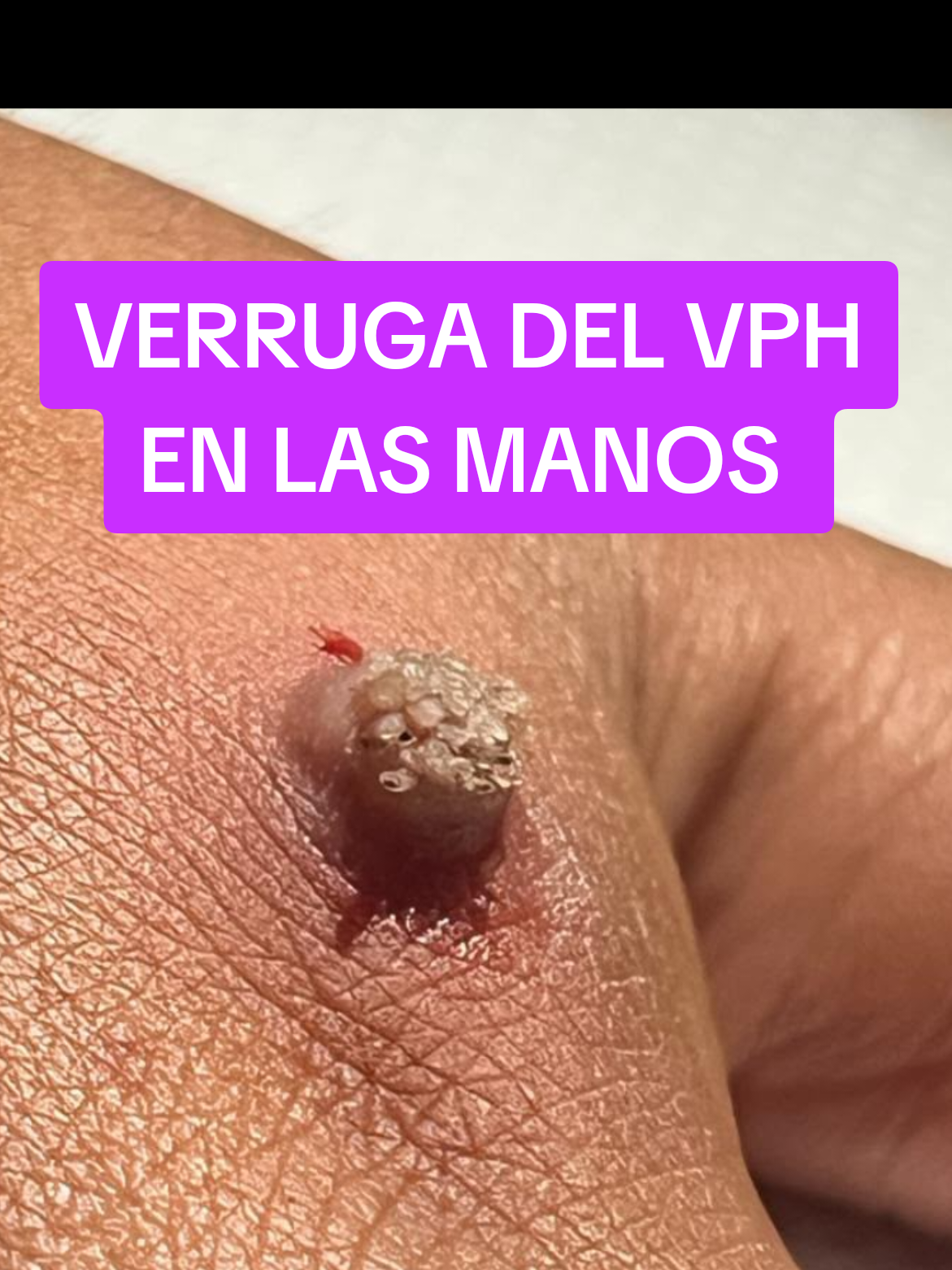 @VPH2025