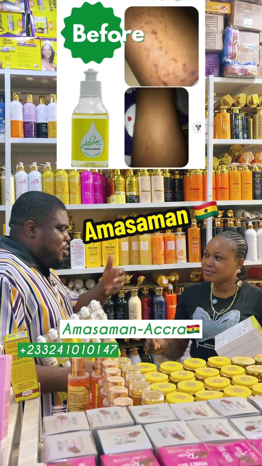 @No1 STRETCH MARKS PRODUCT