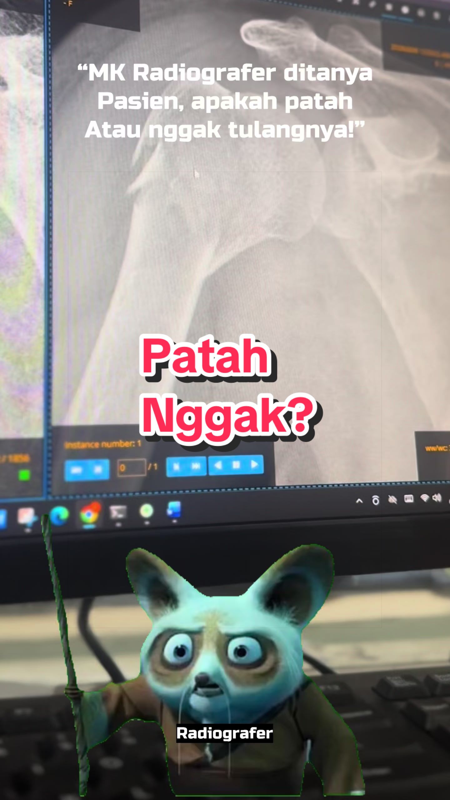 @Sobat Radiology