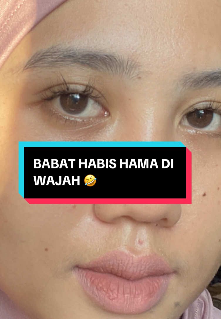 @Penghilangtahilalat.kaq.ay