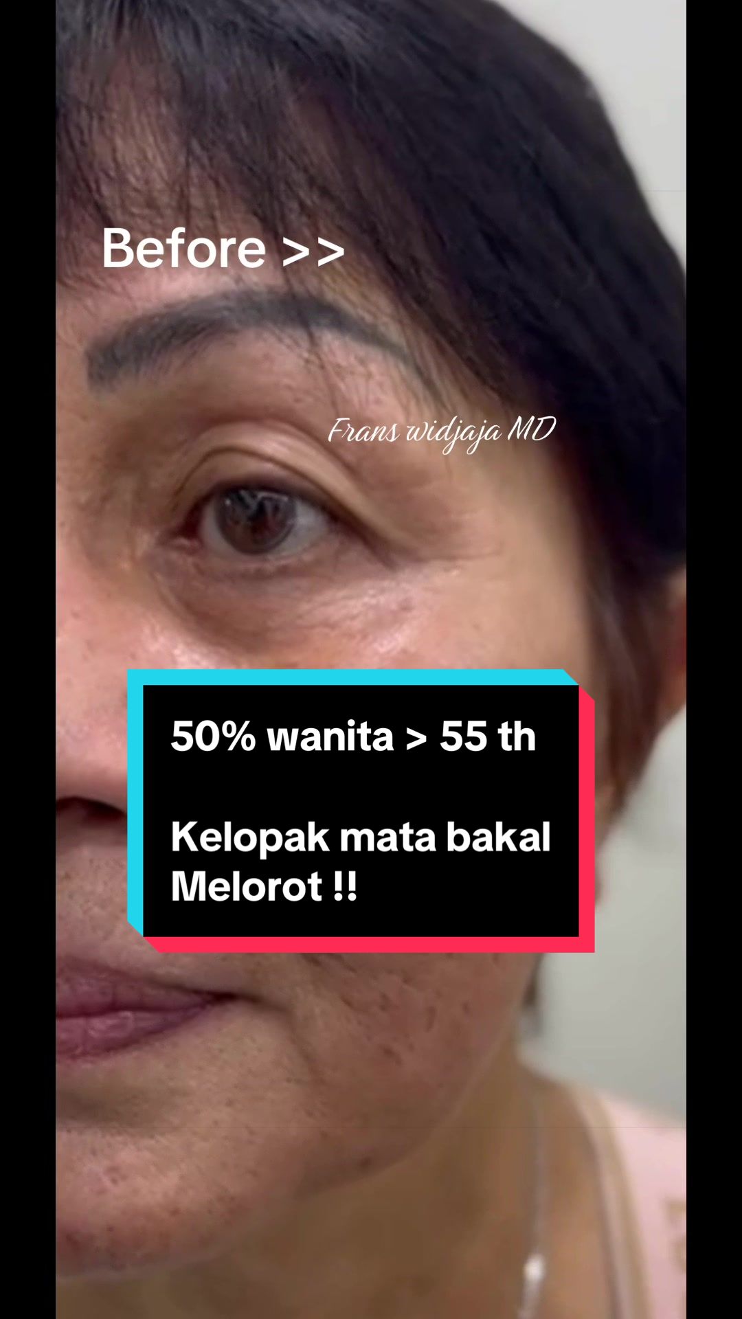 @FransHerywidjaja MD