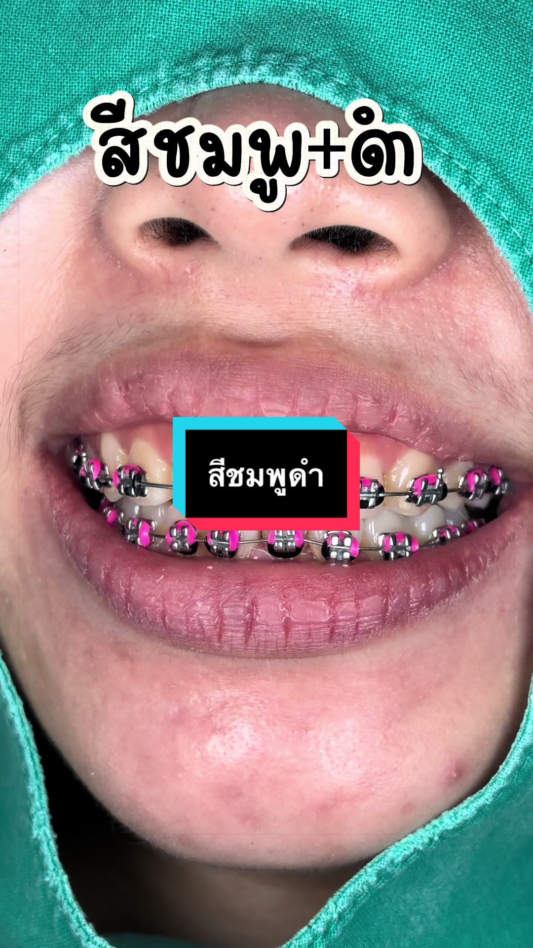 @ซอฟแอนด์สไมล์ลาดกระบัง