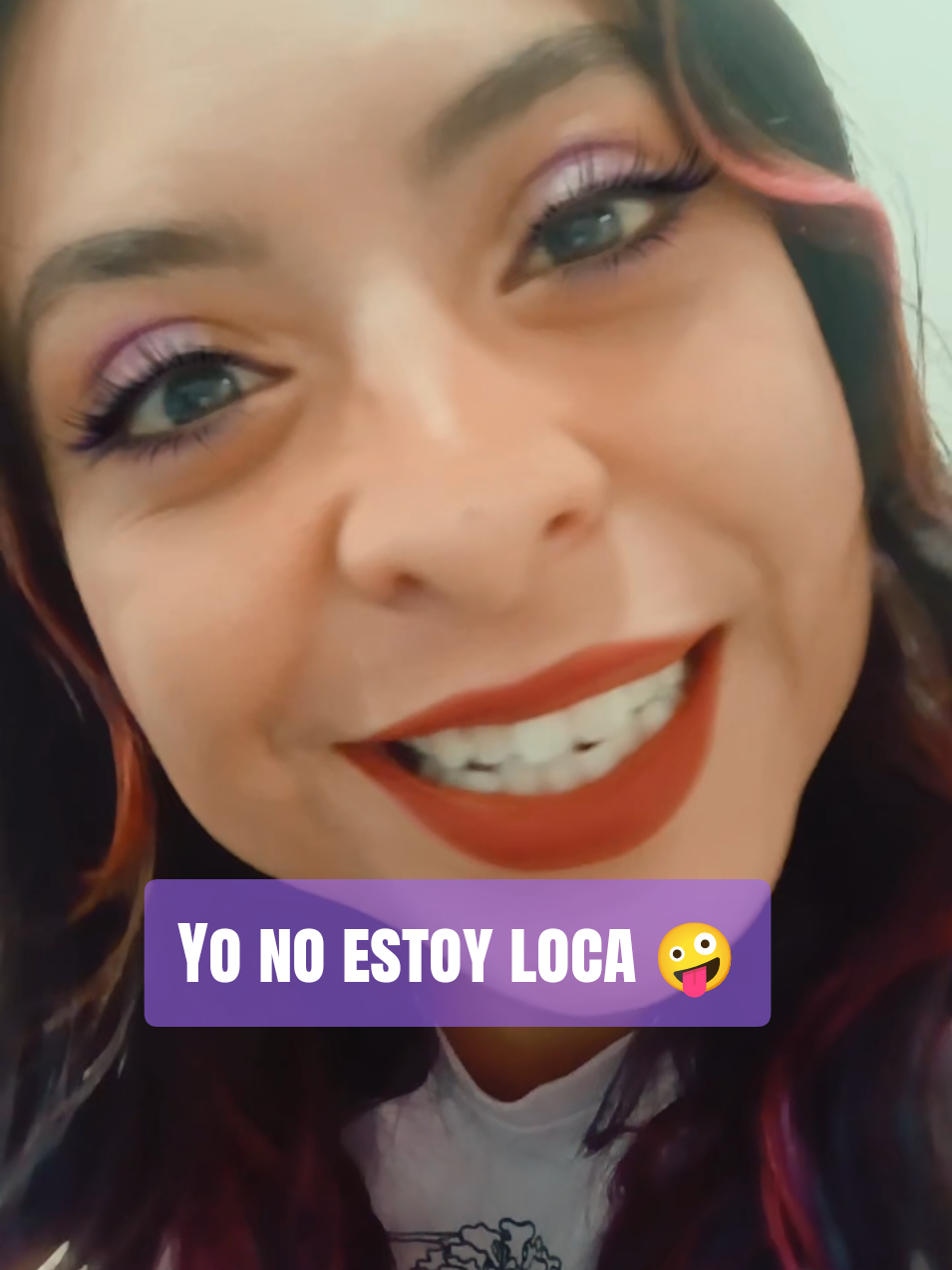 @Abi Guerrero