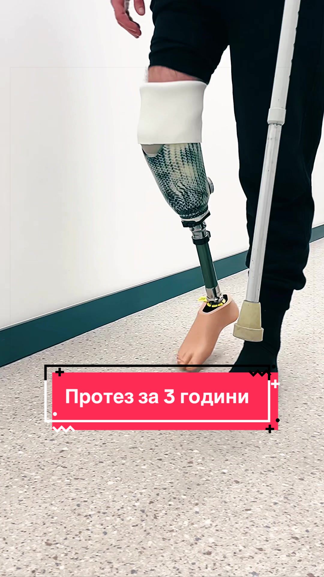 @Сміливий крок. Центр протезів