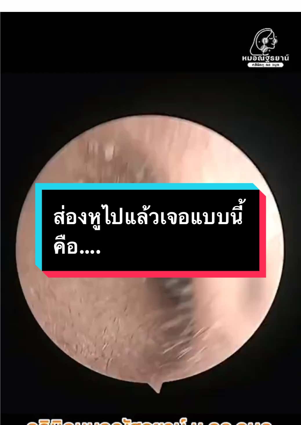 @คลินิกหมอณัฐธยาน์ หู คอ จมูก