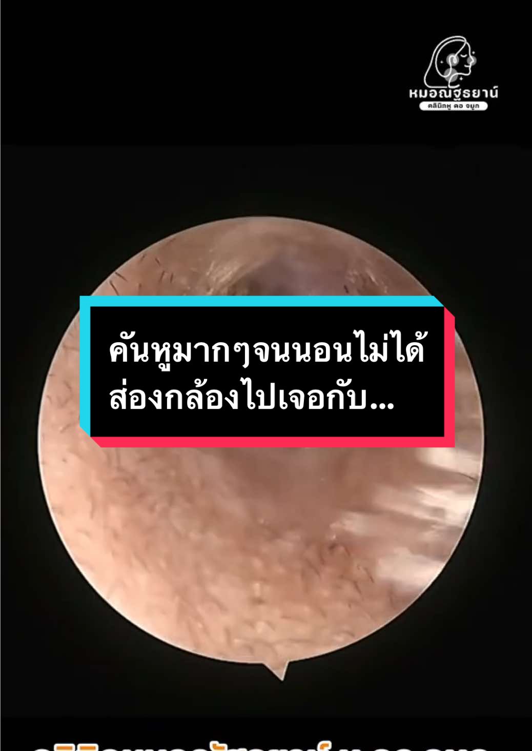 @คลินิกหมอณัฐธยาน์ หู คอ จมูก