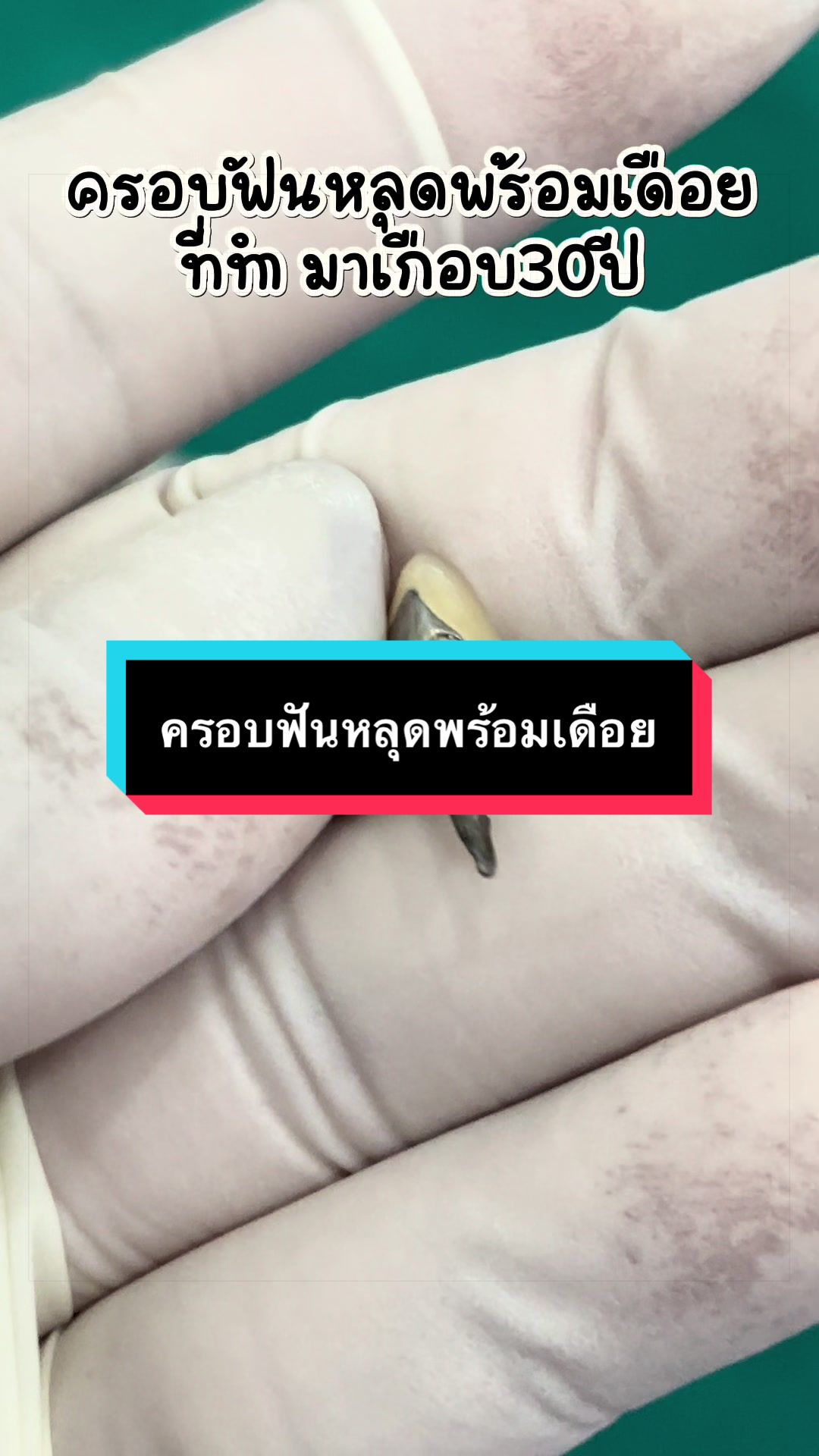 @ซอฟแอนด์สไมล์ลาดกระบัง