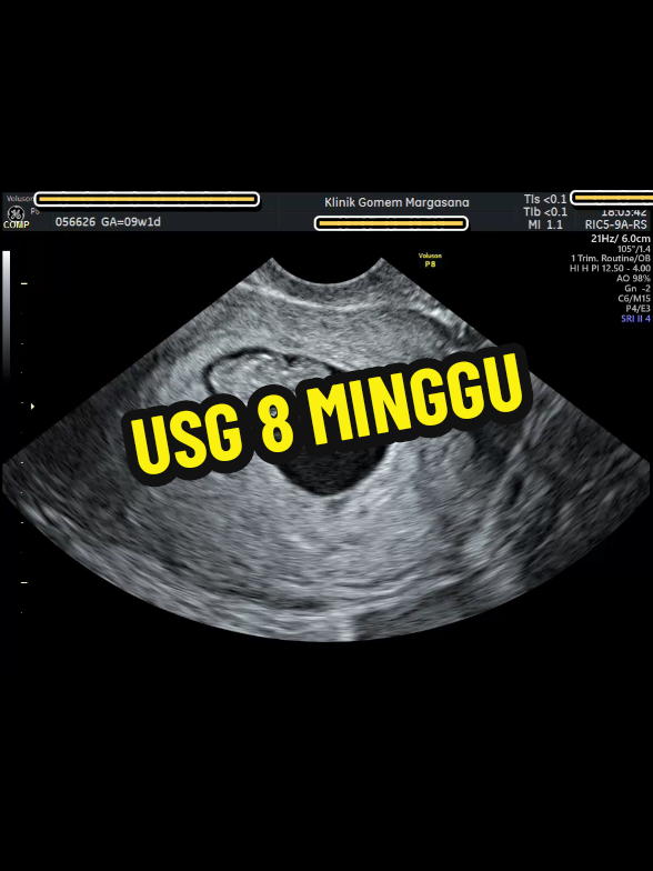@USG 4D PURWOKERTO