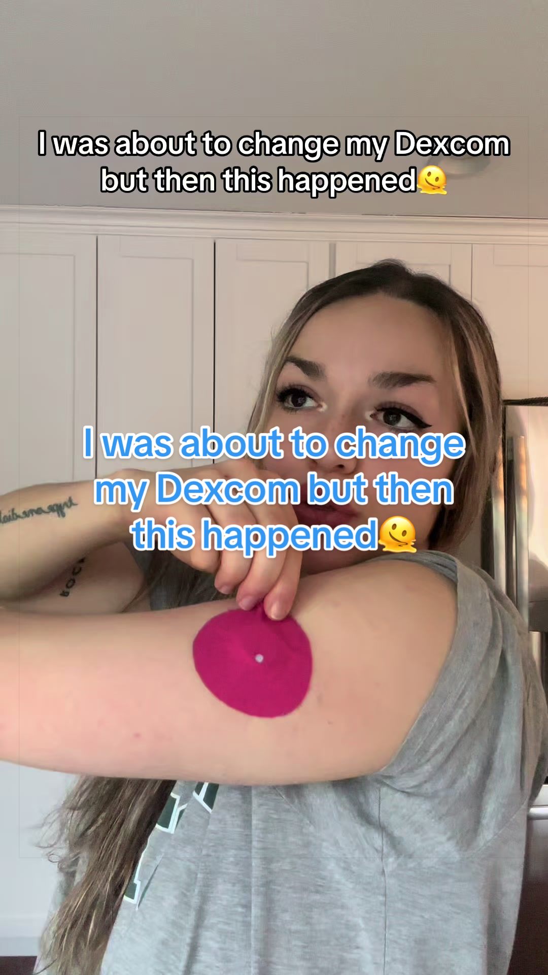 @TYPE 1 DEEABETES