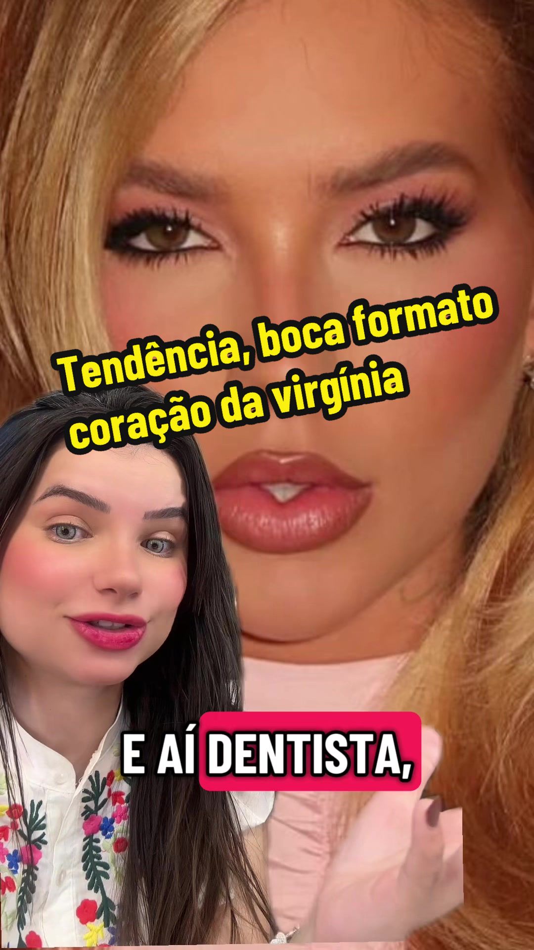 @Manu Froeder