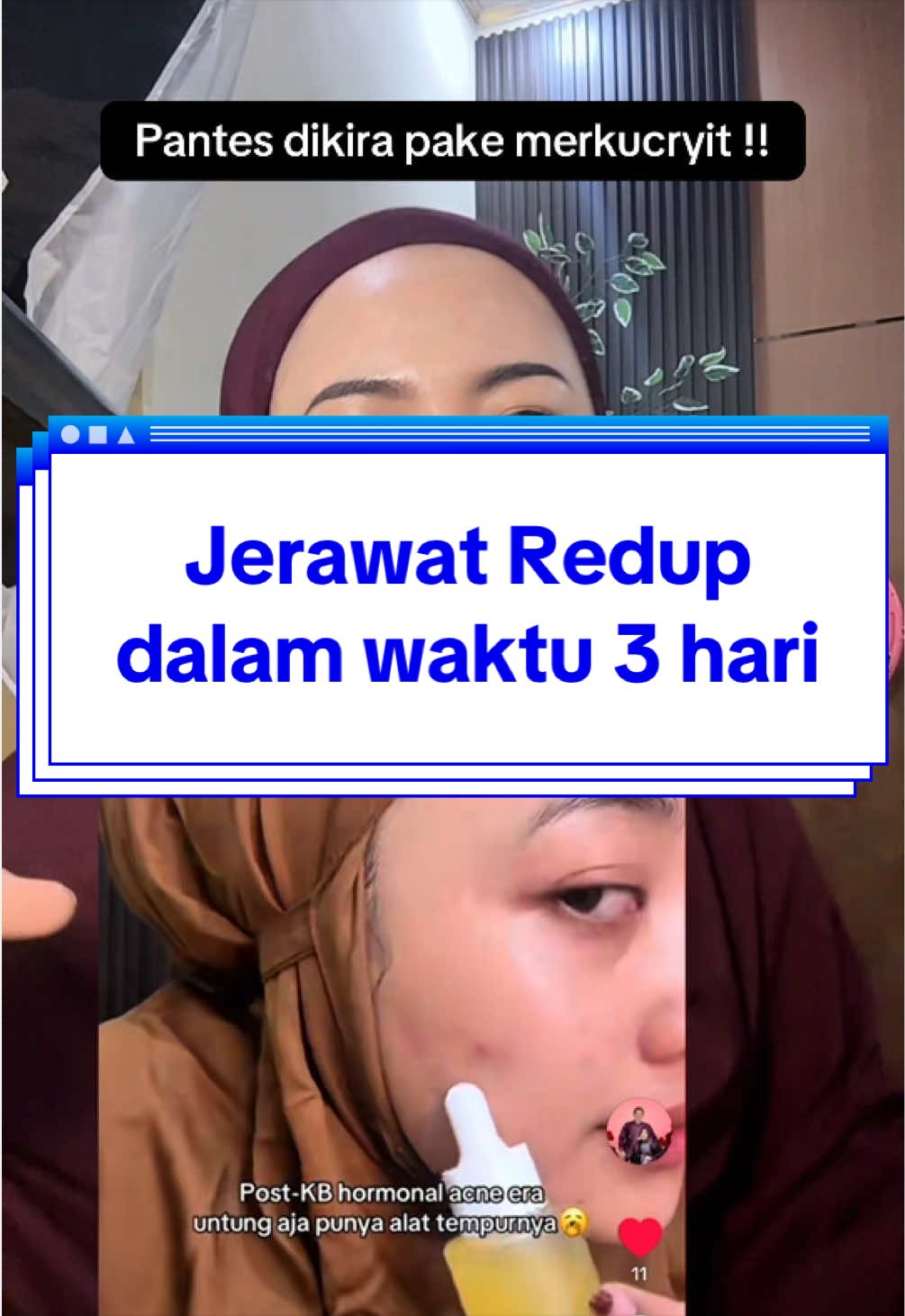 @๐
ท๐
ธ ๐
บ๐
ด๐
ผ๐
ฐ๐๐
พ๐