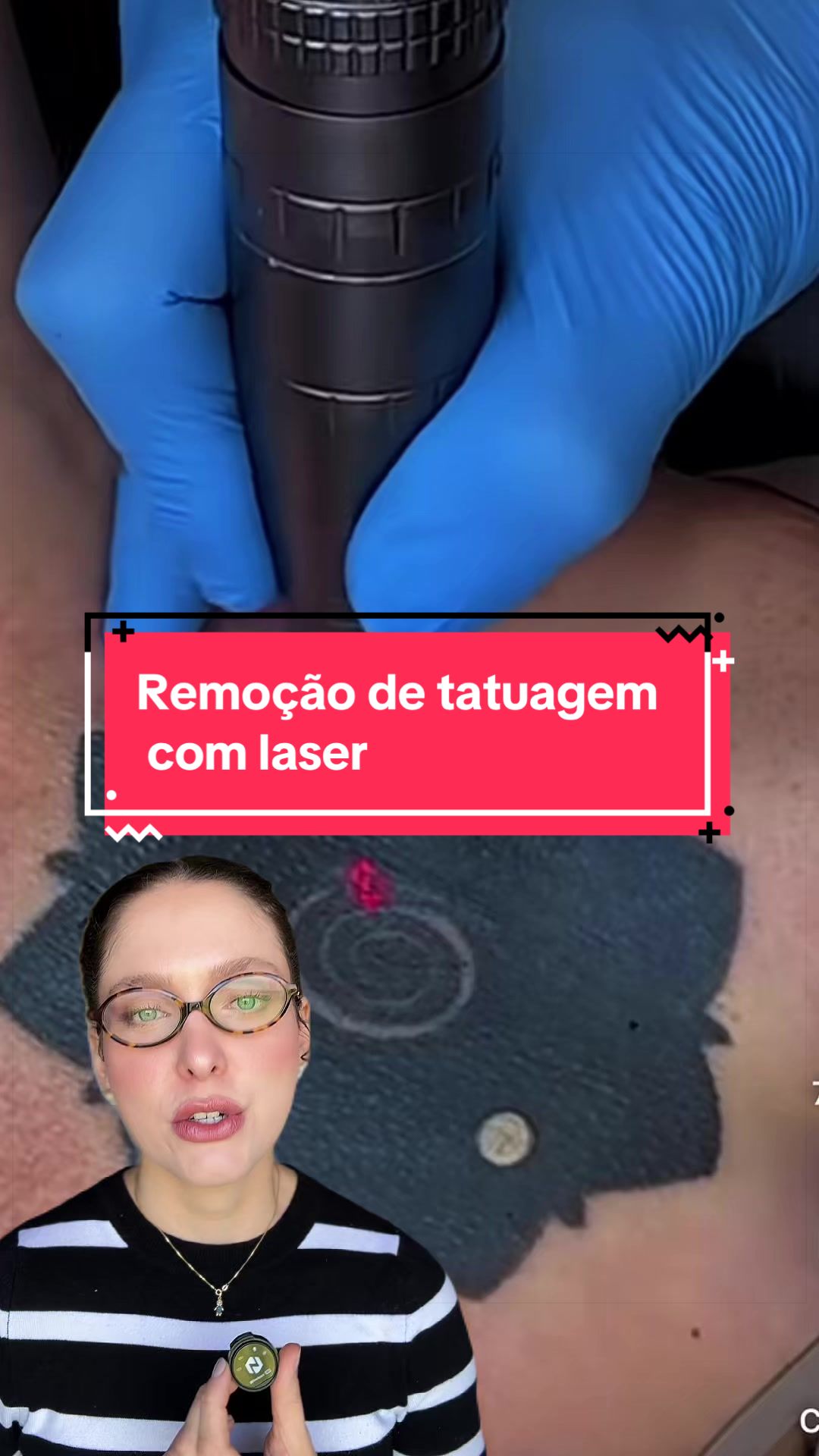 @Lays de Alcântara | Dermato