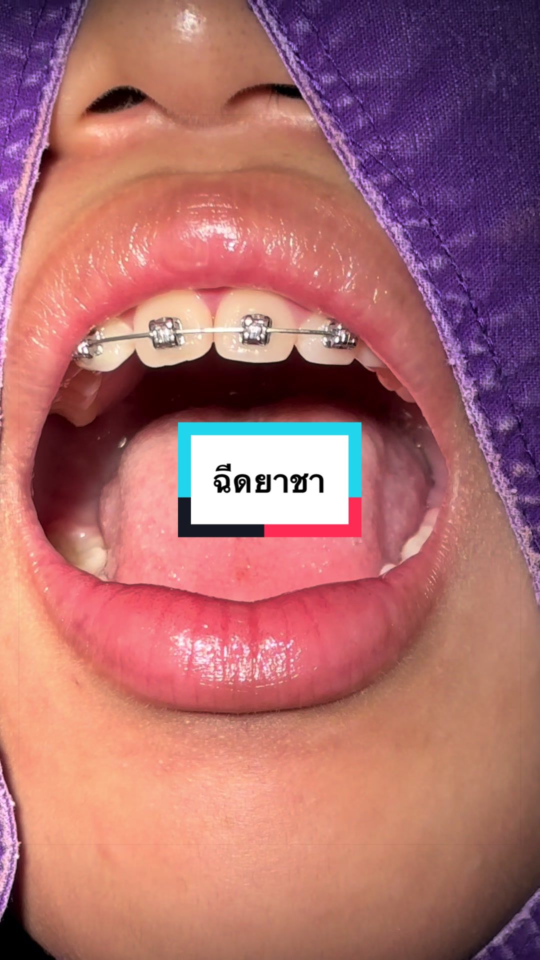 @ซอฟแอนด์สไมล์ลาดกระบัง