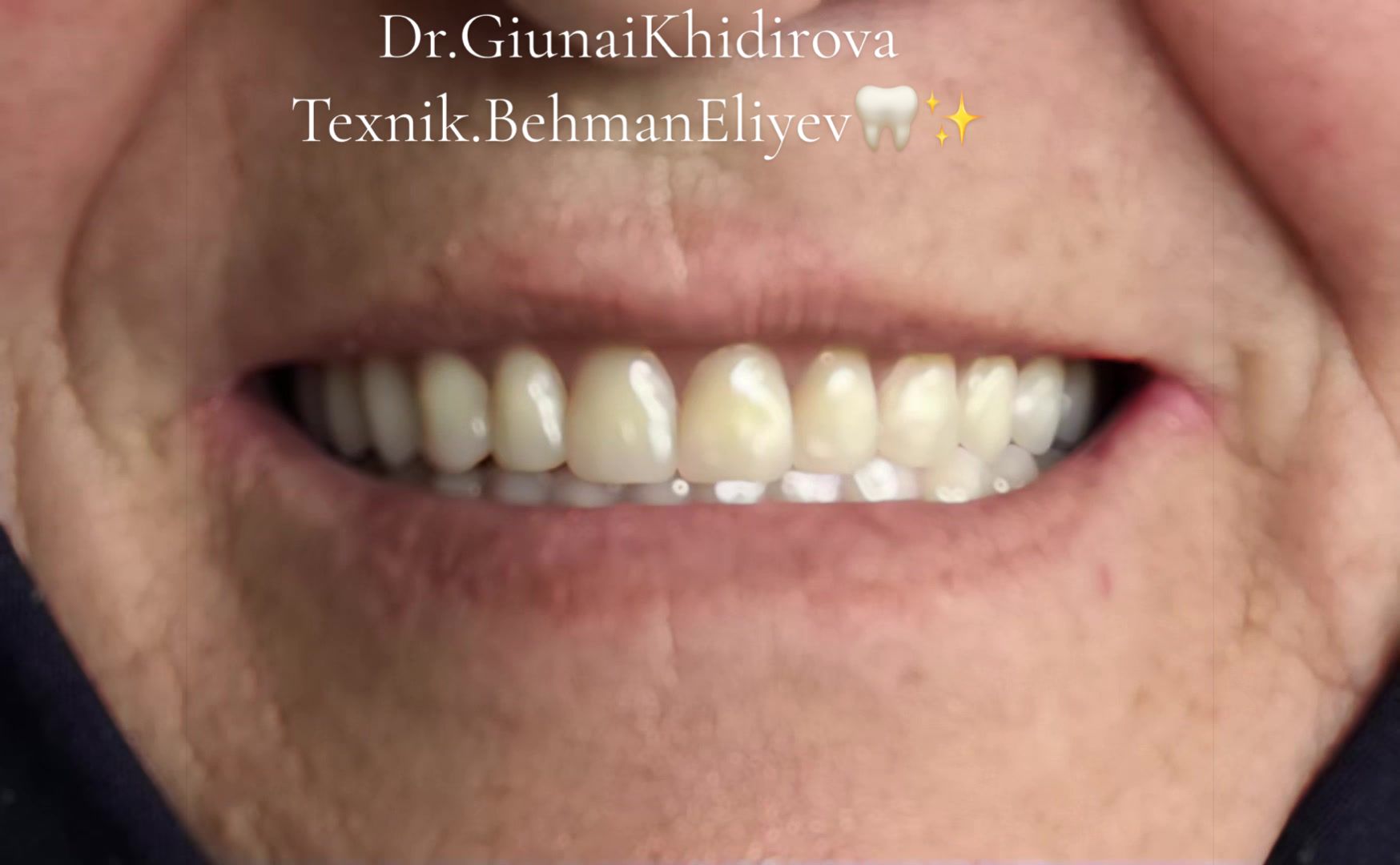 @Dr.Гюнай