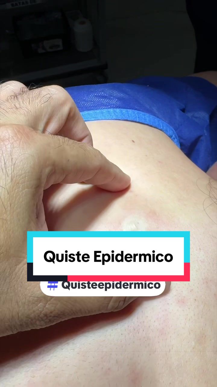 @Dr. Wilfrido Solano Derma