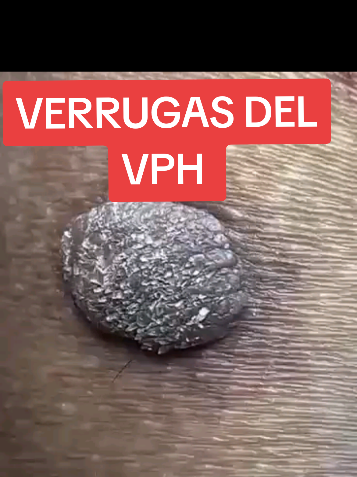 @VPH2025