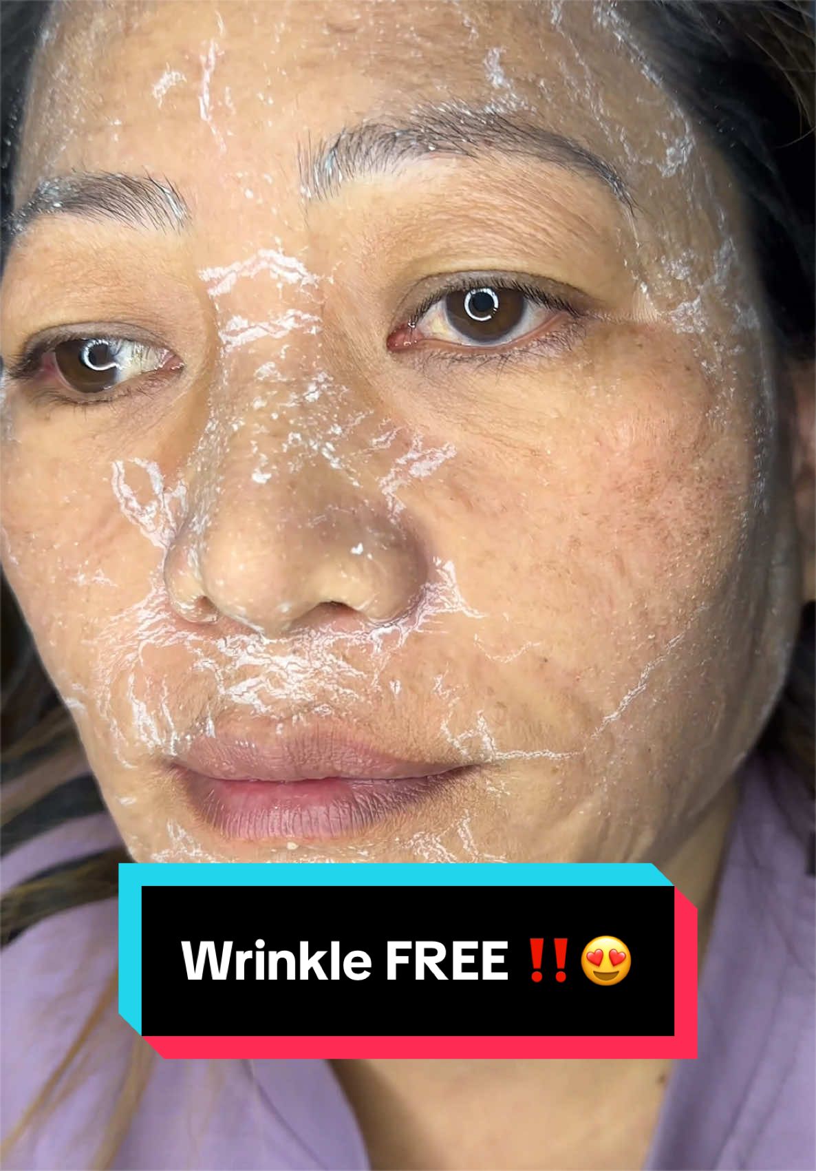 @Minimagic Skincare🇳🇵