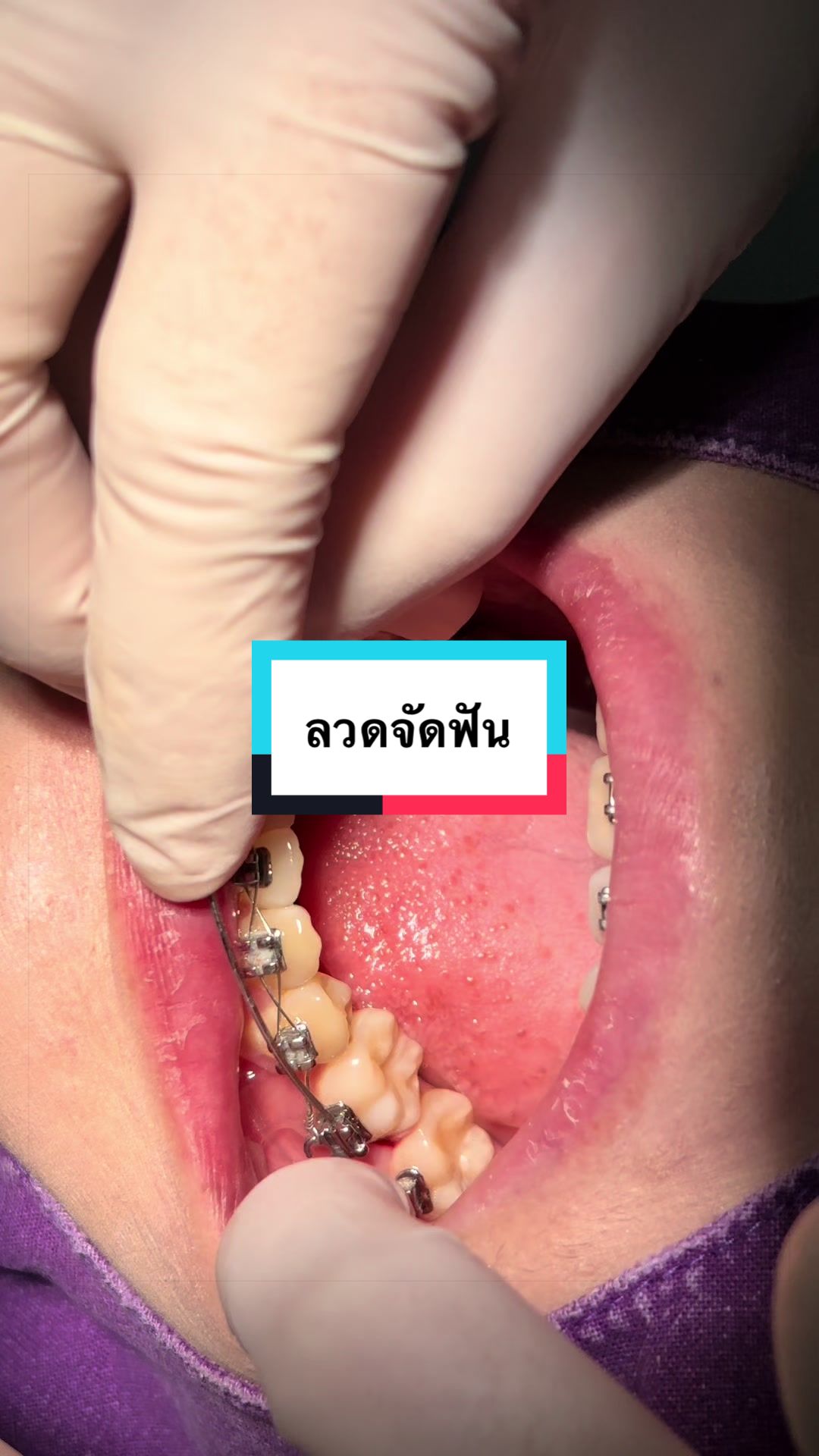 @ซอฟแอนด์สไมล์ลาดกระบัง