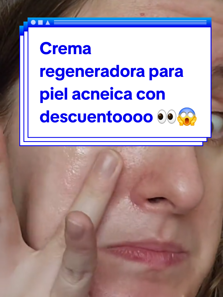 @Puli✨️Dermocosmiatra rebelde