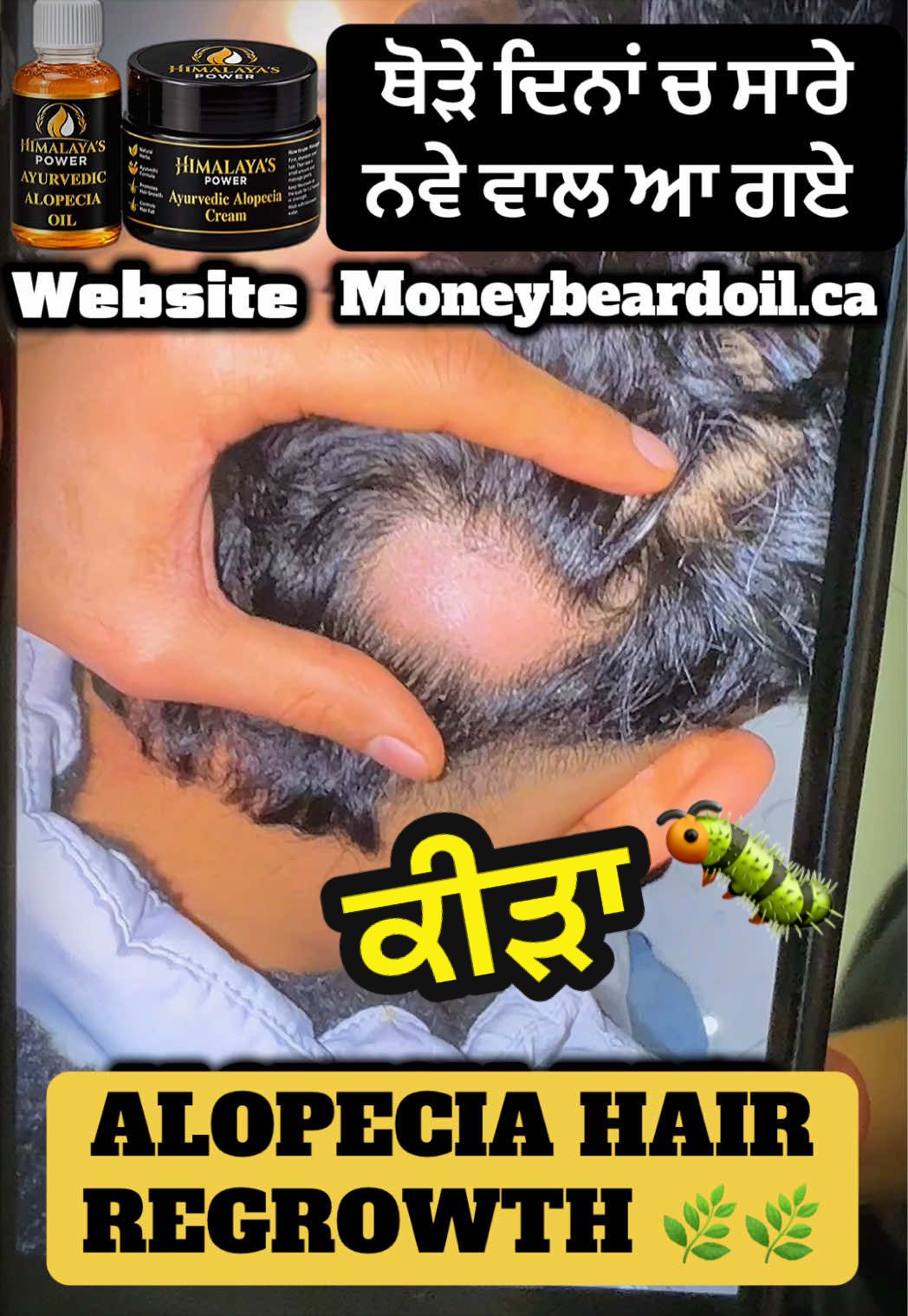 @money_beard_growthoil