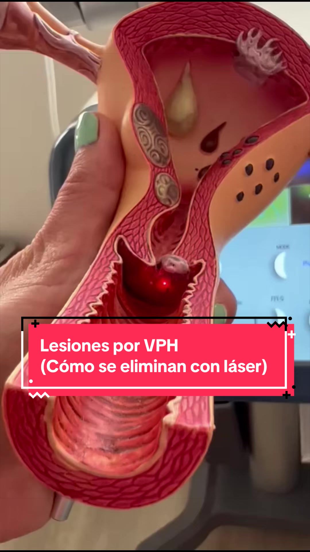 @Dra. Verónica Reyes Ginecóloga