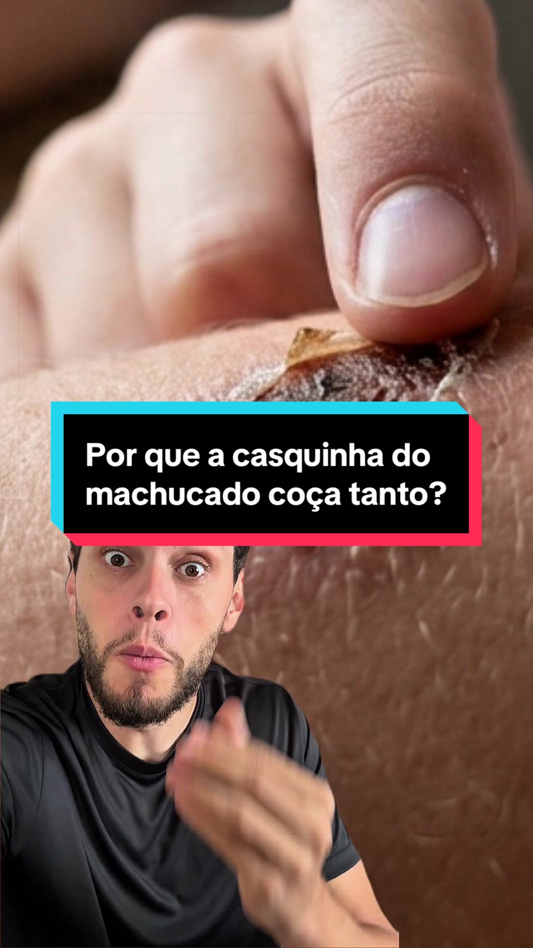 @Fercavs