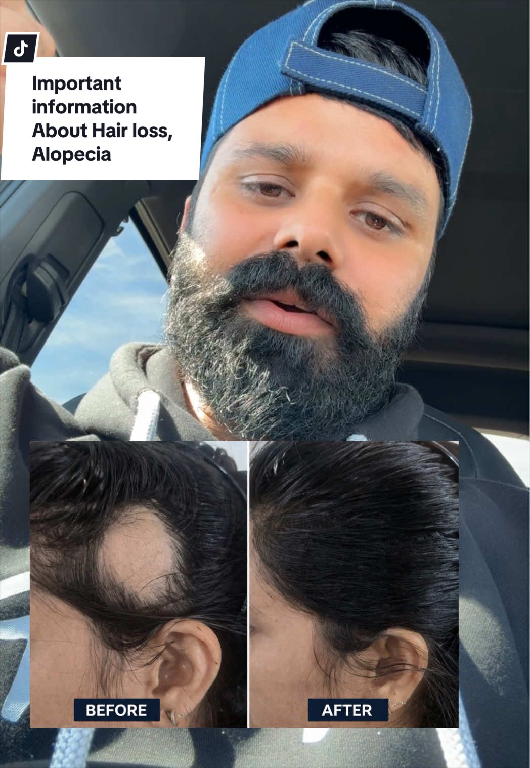 @money_beard_growthoil