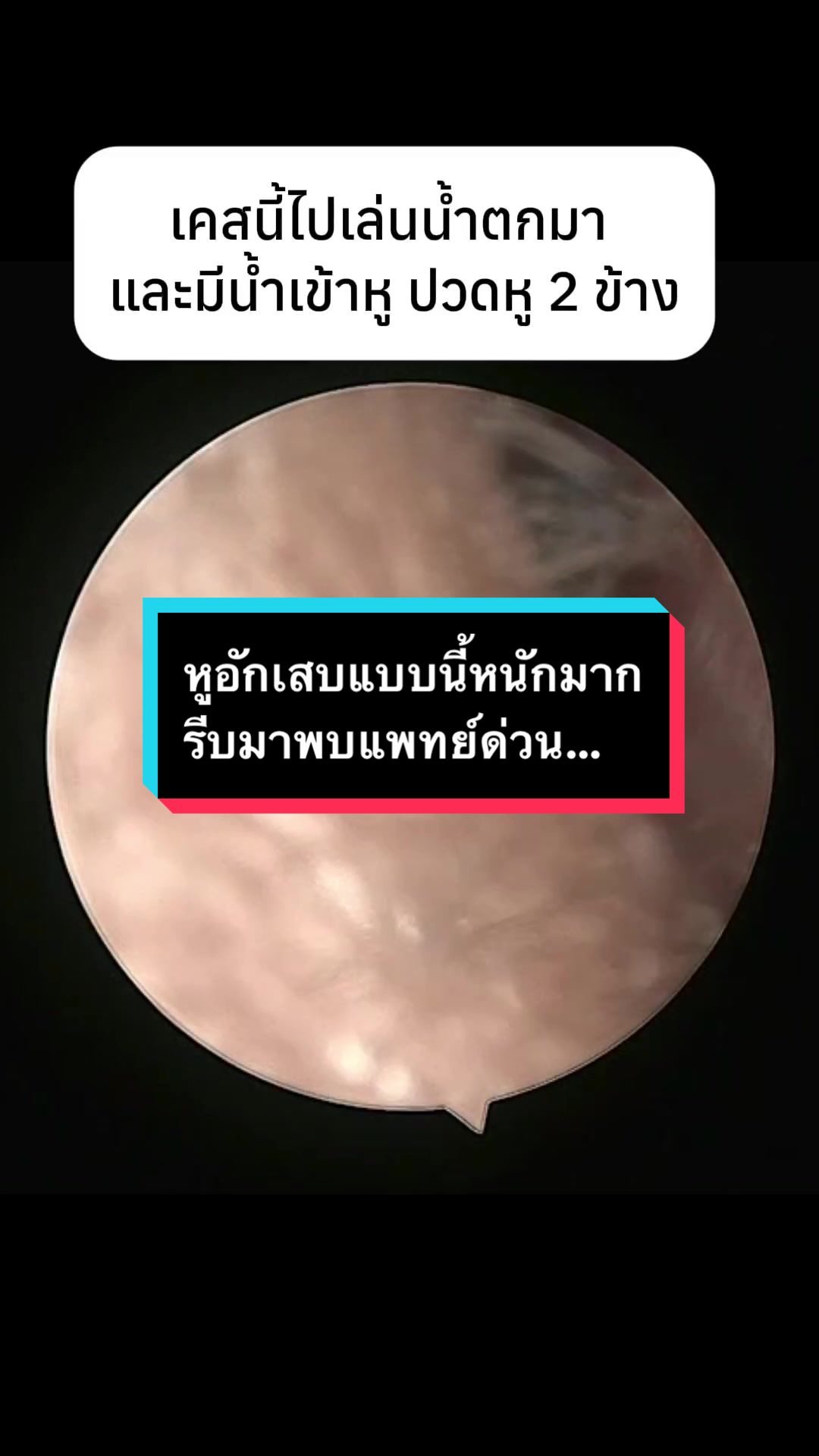@คลินิกหมอณัฐธยาน์ หู คอ จมูก