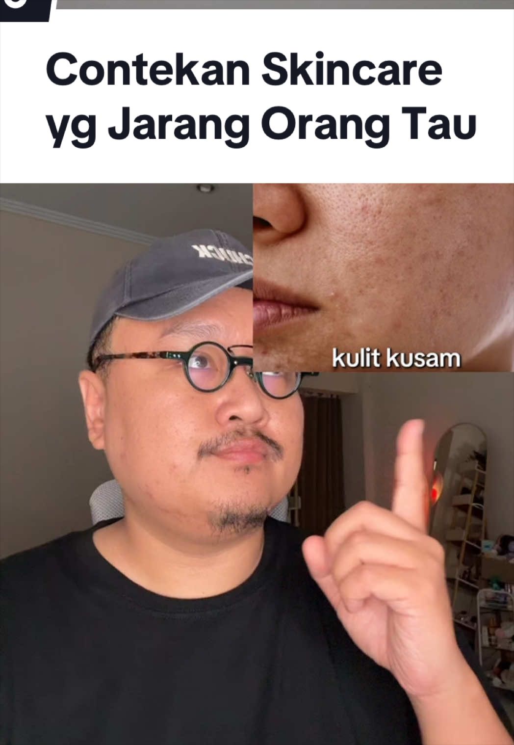 @Ali | @HungryForSkincare