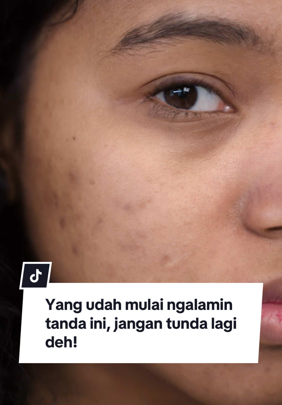 @Duvaderm