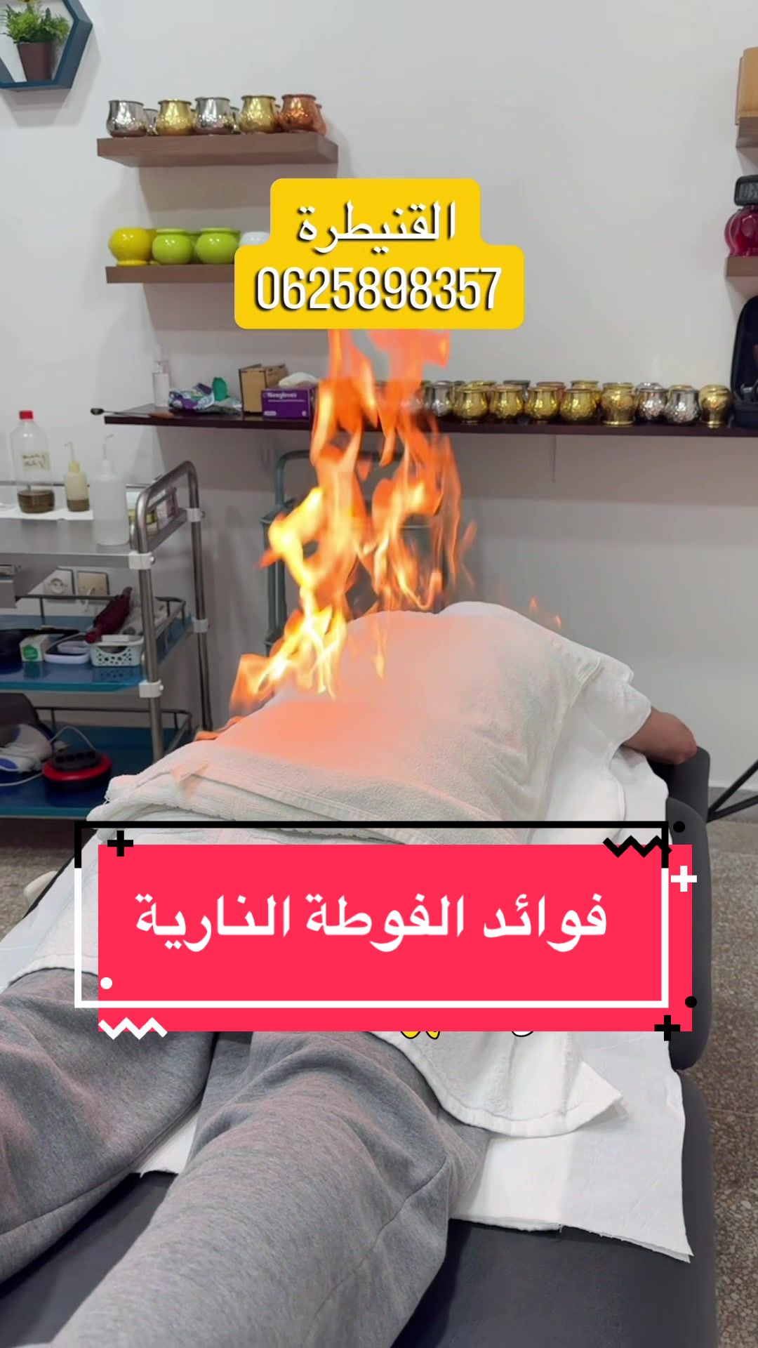 @Hijama.abdelmajid