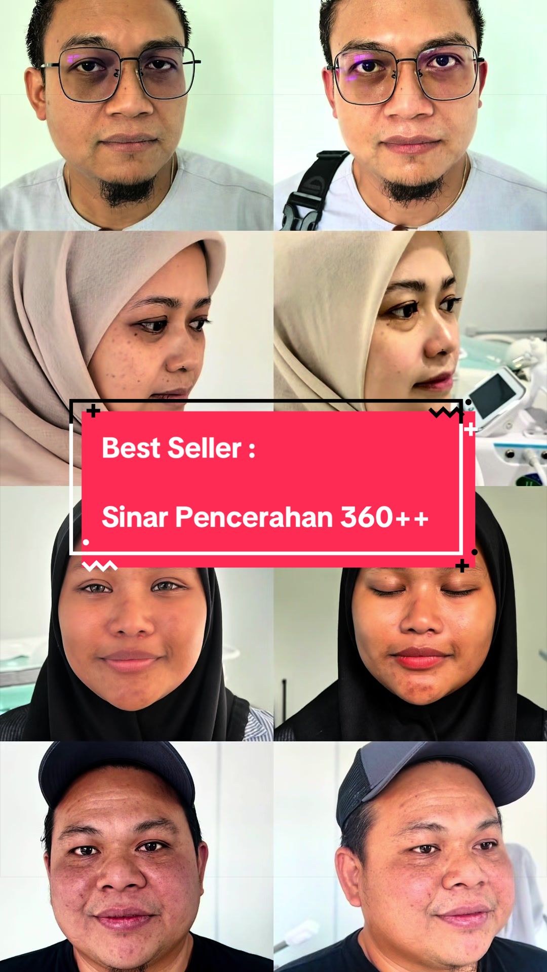 @Jom facial cat