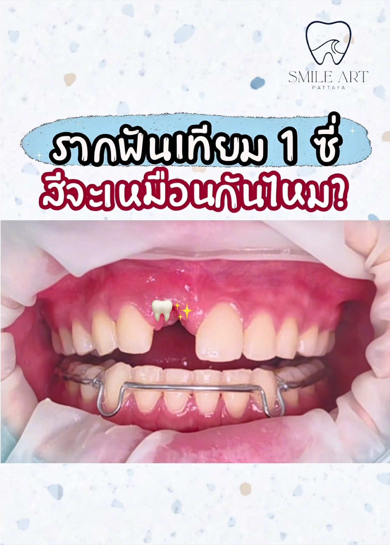 @smile Art Pattaya