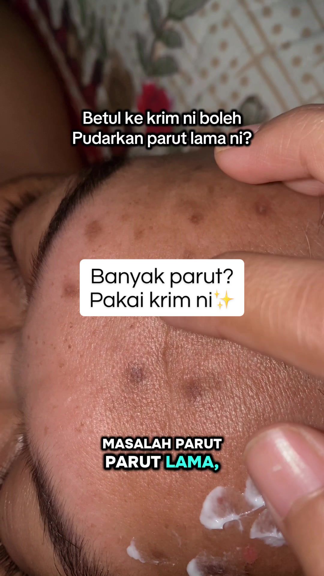 @Shima Zara