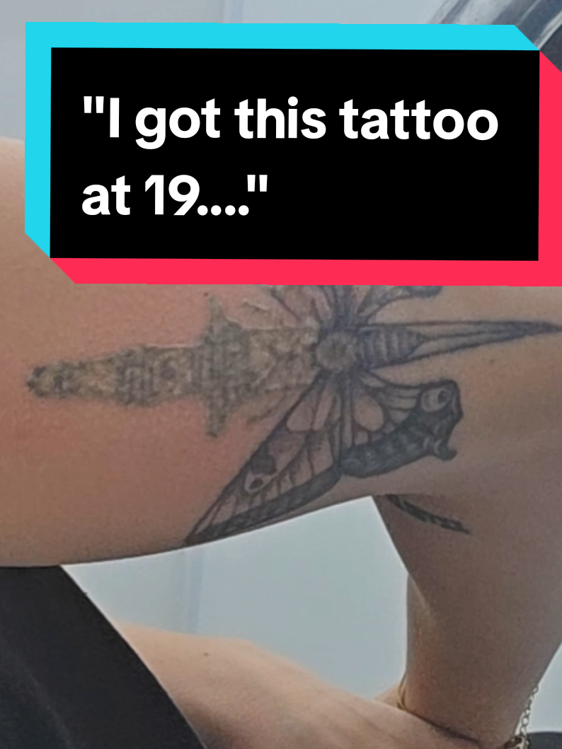 @Jamie T| Tattoo Removal Expert